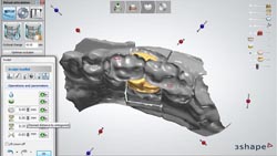 Correct Occlusion